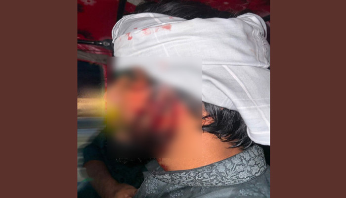 নোয়াখালীতে আওয়ামী লীগ-বিএনপি সংঘর্ষ, পাল্টাপাল্টি অগ্নিসংযোগ, আহত ৬
