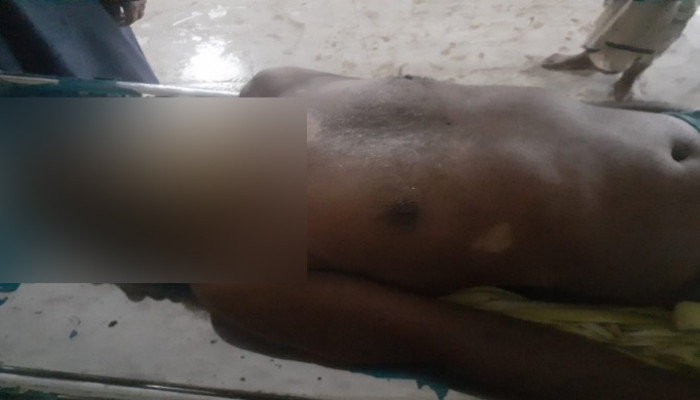 রাণীনগরে বজ্রপাতে এক কৃষকের মৃত্যু