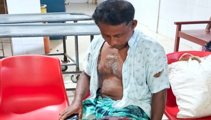 তানোরে বর্গাচাষীকে হাতুড়ি পেটা