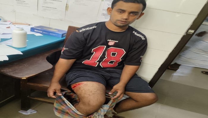 রাজশাহী মহানগরীতে পূর্ব শত্রুতার জেরে স্বেচ্ছাসেবক দল কর্মী মারুফকে কুপিয়ে জখম