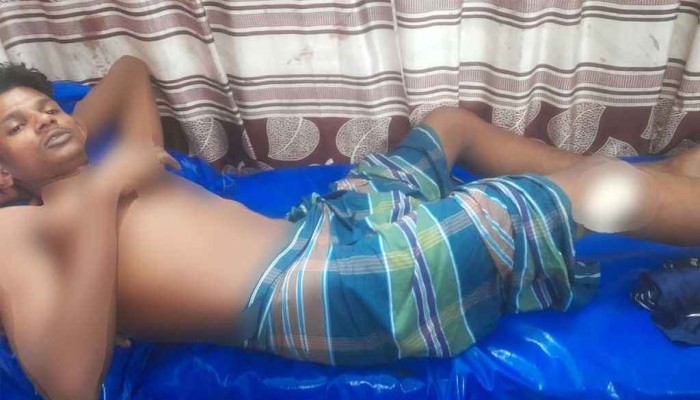 নোয়াখালীতে অটোরিকশাচালককে গুলি করে টাকা ও মোবাইল ছিনতাই