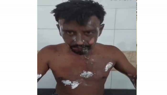 বদলগাছীতে মোটরসাইকেল আরোহীর গায়ে আগুন দেওয়ার অভিযোগ, যুবক আটক