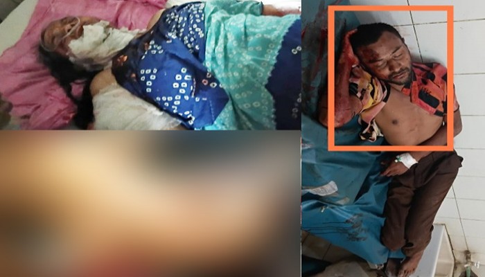 মাদকাসক্ত ছেলের ধারালো বঁটির কোপে মা ও ভাই গুরুতর আহত, গ্রেফতার ছেলে