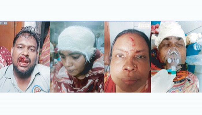 মতিহারে সীমানা নিয়ে সংঘর্ষে একই পরিবারের আহত ৫, হাসপাতালে ভর্তি ২